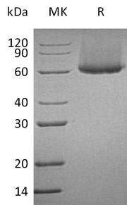 Recombinant Human CRTAM (C-6His)