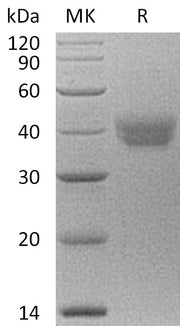 Recombinant Human ESAM (C-6His)