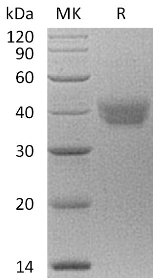 Recombinant Human ESAM (C-6His)