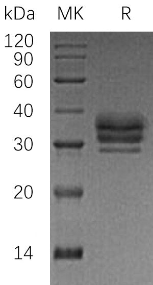 Recombinant Human LTBR (C-6His)