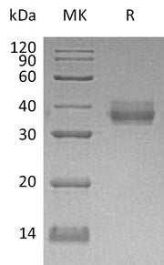 Recombinant Human EpCAM (C-6His)