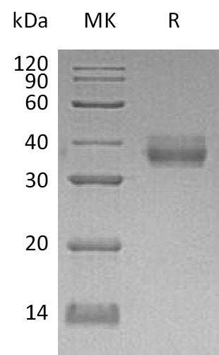 Recombinant Human EpCAM (C-6His)