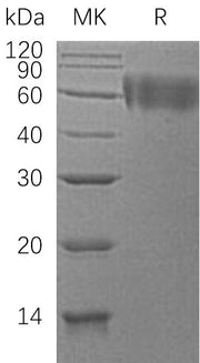 Recombinant Human DR6 (C-6His)