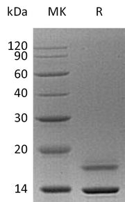 Recombinant Human CST6 (C-6His)