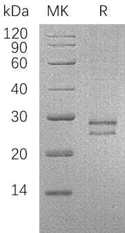 Recombinant Human CRISP-3 (C-6His)