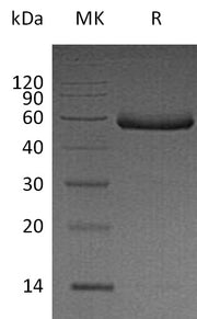 Recombinant Human Fetuin B (C-6His)