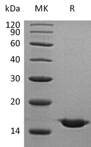 Recombinant Human CST2 (C-6His)