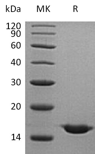 Recombinant Human CST2 (C-6His)