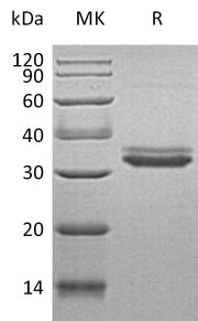 Recombinant Human IGFBP-4 (C-6His)