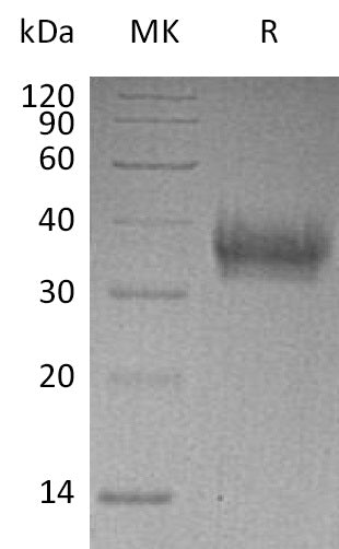 Recombinant Human EPCR (C-6His)