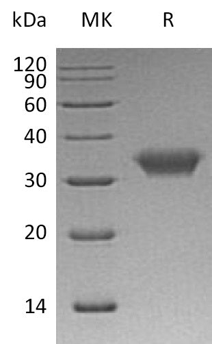 Recombinant Human CAR (C-6His)