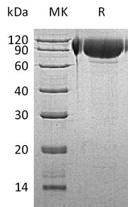 Recombinant Human GNS (C-6His)