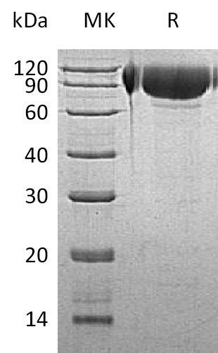 Recombinant Human GNS (C-6His)