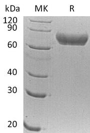 Recombinant Human FLRT1 (C-6His)