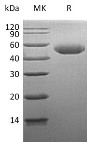 Recombinant Human GLA (C-6His)