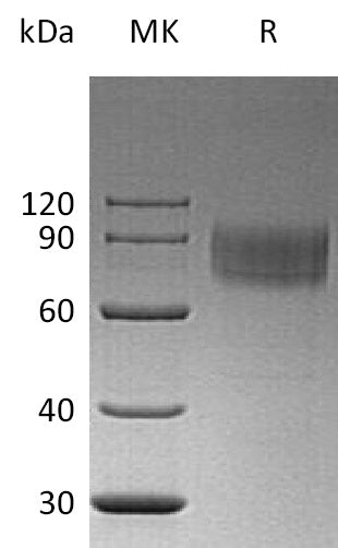 Recombinant Human IFNAR1 (C-6His)