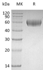 Recombinant Human Lumican (C-6His)