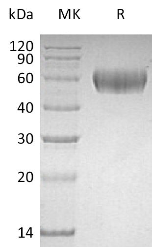 Recombinant Human Lumican (C-6His)
