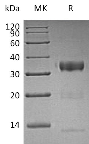 Recombinant Human KLK10 (C-6His)