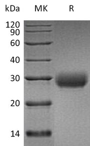 Recombinant Human LAIR1 (C-6His)