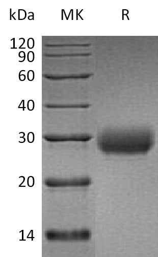 Recombinant Human LAIR1 (C-6His)