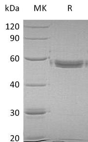 Recombinant Human MMP-1 (C-6His)