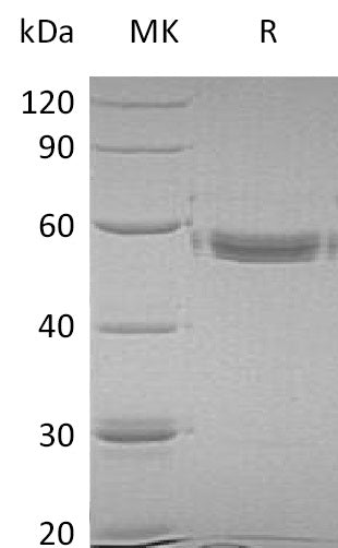 Recombinant Human MMP-1 (C-6His)