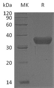 Recombinant Human KLK8 (C-6His)