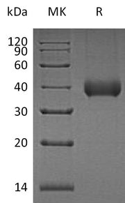 Recombinant Human KLK11 (C-6His)