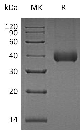 Recombinant Human KLK11 (C-6His)