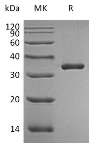 Recombinant Human KLK3 (244AA, C-6His)