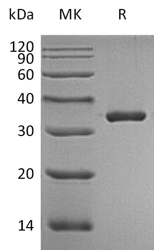 Recombinant Human KLK3 (244AA, C-6His)