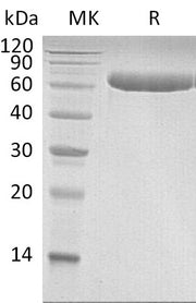 Recombinant Human LBP (C-6His)