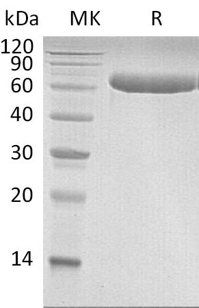 Recombinant Human LBP (C-6His)