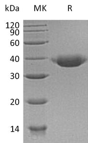 Recombinant Human JAM-B (C-6His)