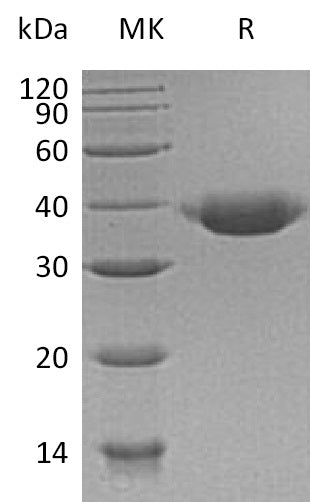 Recombinant Human JAM-B (C-6His)
