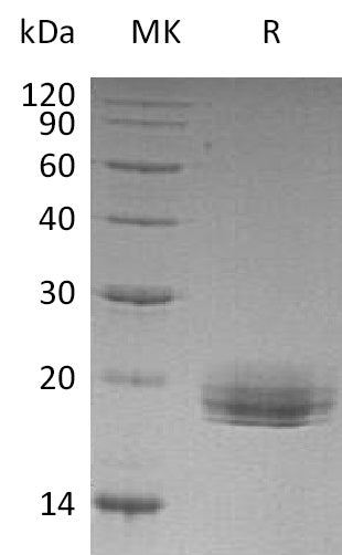 Recombinant Human LAIR2 (C-6His)