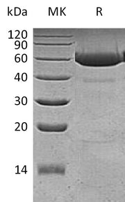 Recombinant Human Legumain (C-6His)