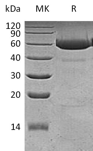 Recombinant Human Legumain (C-6His)