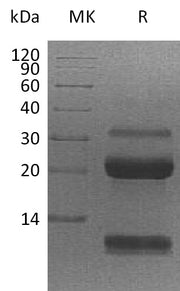 Recombinant Human KLK6 (C-6His)