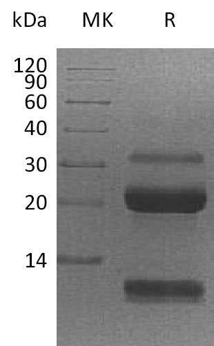 Recombinant Human KLK6 (C-6His)