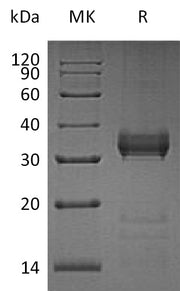 Recombinant Human KLK13 (C-6His)