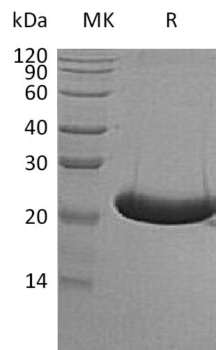 Recombinant Human TREML1 (C-6His)