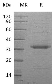 Recombinant Human BSSP-4 (C-6His)