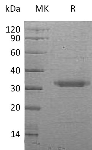 Recombinant Human BSSP-4 (C-6His)