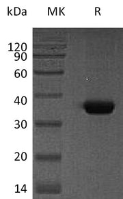 Recombinant Human SPARC (C-6His)