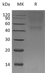 Recombinant Human BGN (C-6His)