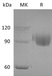 Recombinant Human PIgR (C-6His)