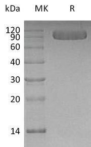 Recombinant Human Vasorin (C-6His)