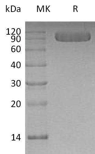 Recombinant Human Vasorin (C-6His)